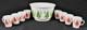 Hazel Atlas Christmas Tree Milk Glass Punch Bowl And 8 Cups Mugs Vintage Set