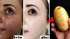Japanese Secret To Whitening 10 Degr Es That Eliminates Pigmentation And Dark Spots